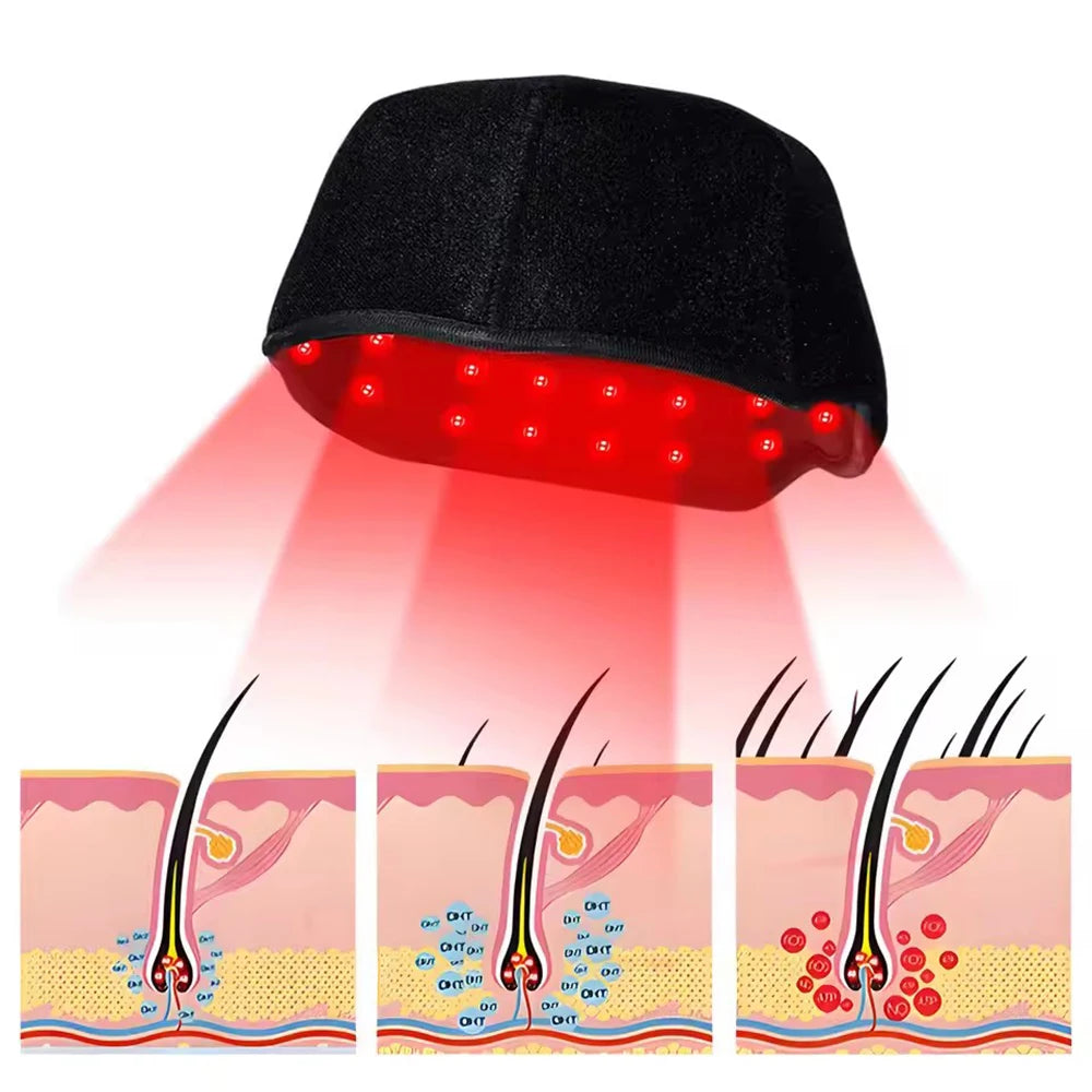 Red Light Therapy Cap for Hair Growth & Thinning – 660nm & 850nm Infrared LED Scalp Care Hat