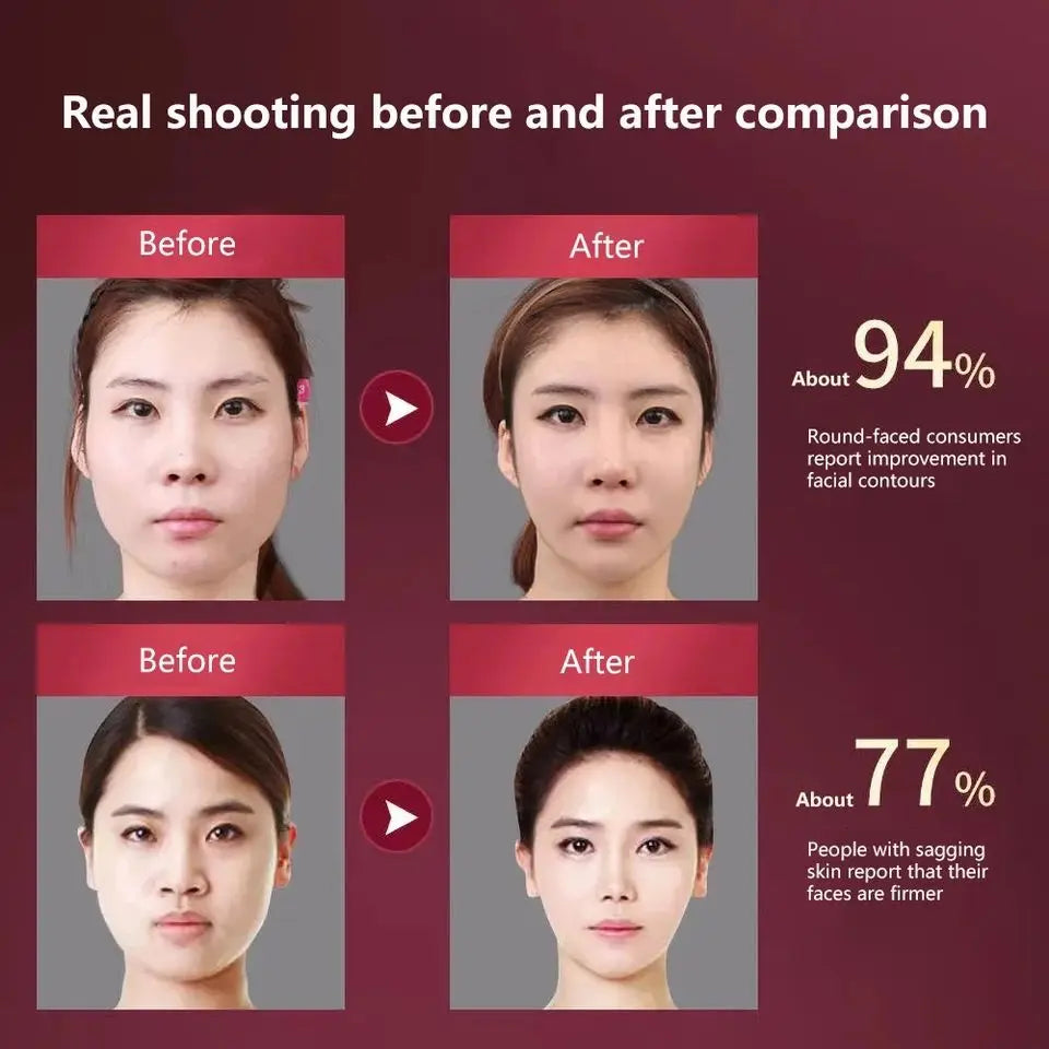 LED V-Face Lifting Massager – Photon Therapy & EMS Slimming Tool