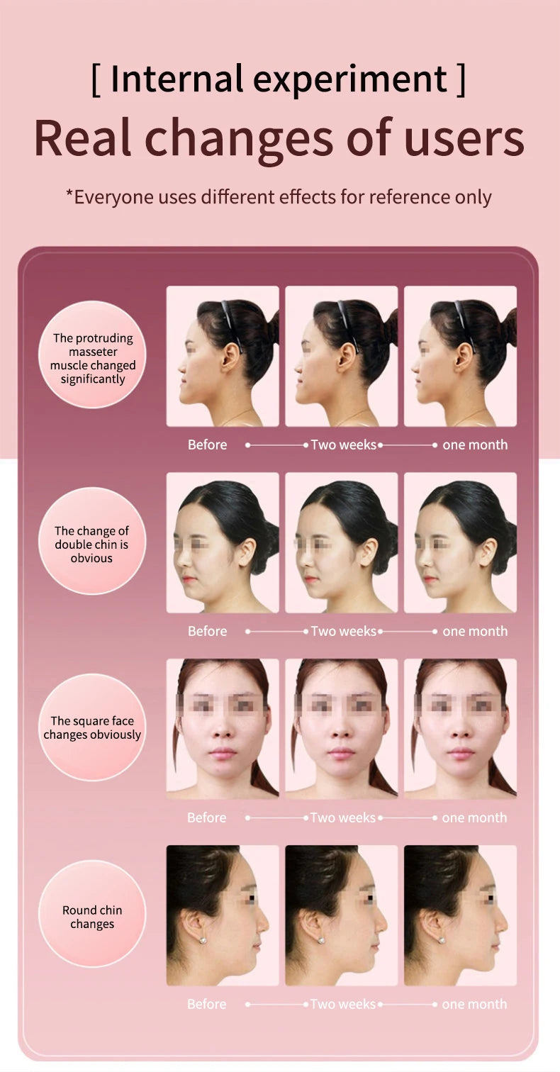 LED V-Face Lifting Massager – Photon Therapy & EMS Slimming Tool