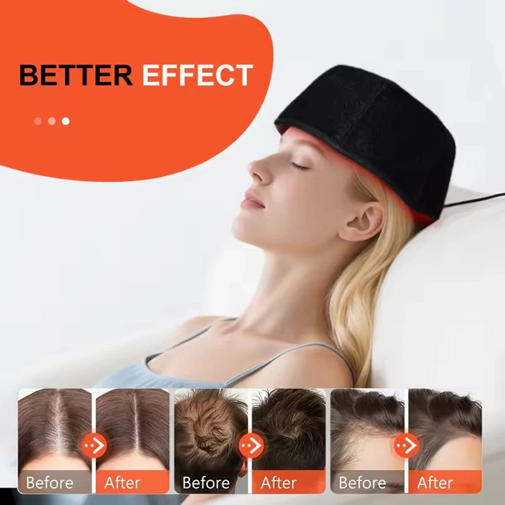 Red Light Therapy Cap for Hair Growth & Thinning – 660nm & 850nm Infrared LED Scalp Care Hat