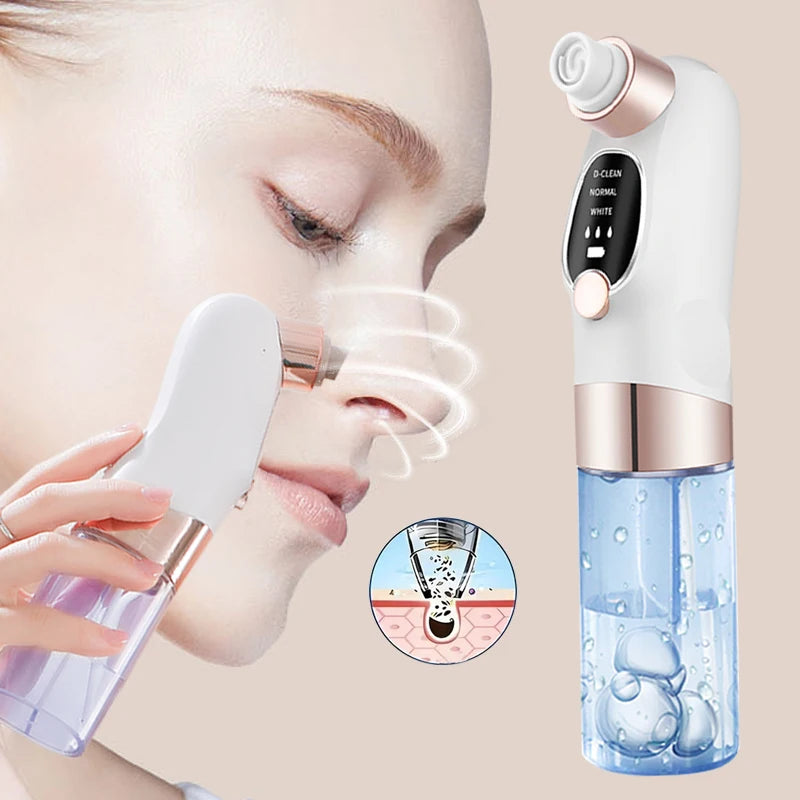 Professional Facial Pore Cleaner – 5-Probe Gentle Blackhead Vacuum & Skin Purifier